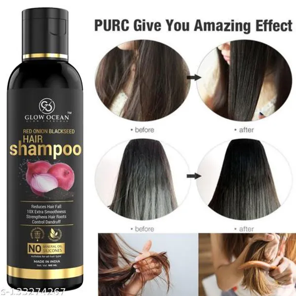 Professional_Ocean_Red_Onion_Blackseed_Hair_Shampoo_For_Hair_Loss_Treatment,Hair_Growth,Control_Dandruff,Hair_Shine_Shampoo,Onion_Shampoo_For_Hair,Hair_Shampoo_Onion,Best_Shampoo_For_Hair_Fall,Best_Shampoo_For_Dandruff,Bal_Badhane_Ka_Shampo,Red_Onion_Shampoo