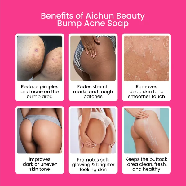 Aichun_Beauty_Back_&_Butt_Bum_Buttock_Soap_for_Dark_Spots_and_Body_Acne