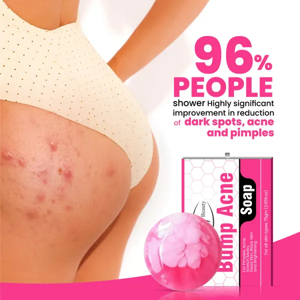 Aichun_Beauty_Back_&_Butt_Bum_Buttock_Soap_for_Dark_Spots_and_Body_Acne