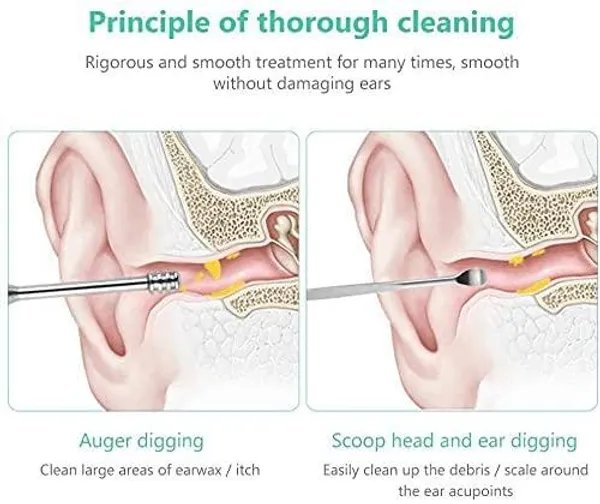 Multicolor_Ear_Wax_Removal_Kit