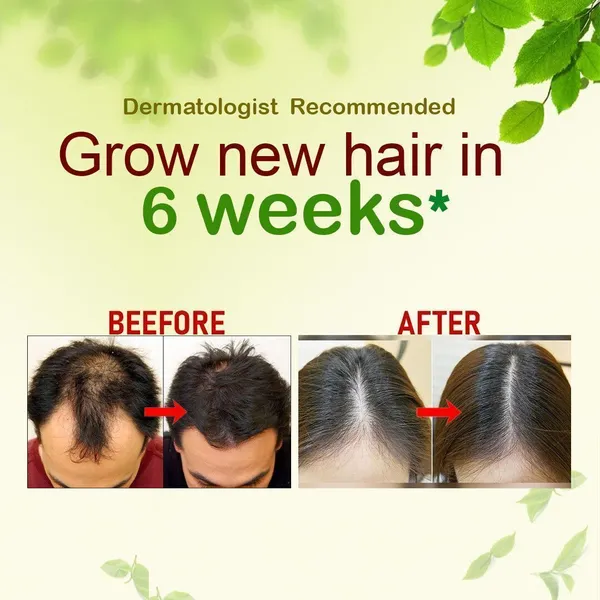 Queen__For_Anti_Hair_Fall,_Anti_Dandruff,_Long,_Healthy,_Nourished_Hair_Oil_For_Men_&_Women