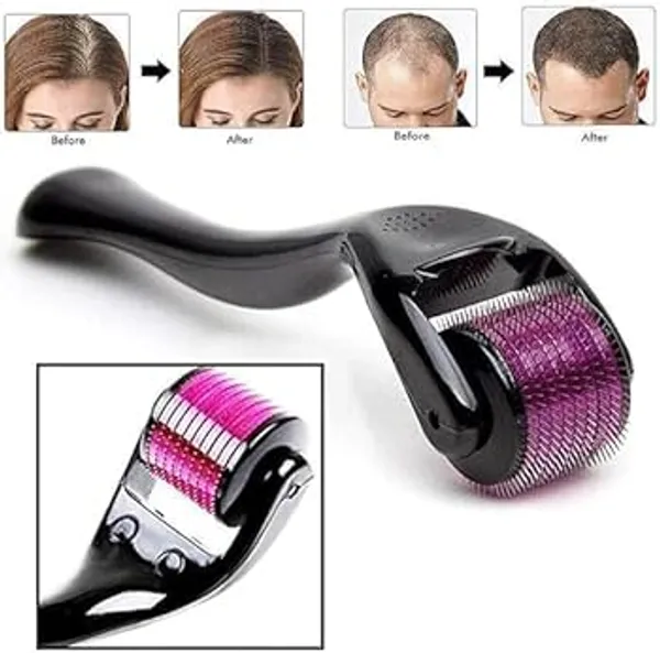 Derma_Roller_0.5mm_With_540_Needles