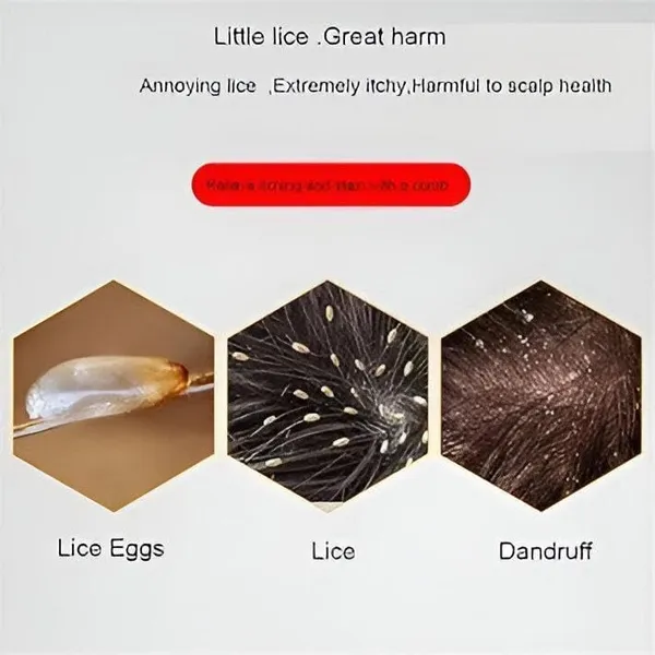 Yellow_Hair_Nit_Combs_Double_Sided_For_Kids_Adults_Lice_Combs_For_Cat_Dog_Long_Hair|_Hair_Care_&_Styling_|_Brushes_&_Combs|1_Hair_Nit_Comb