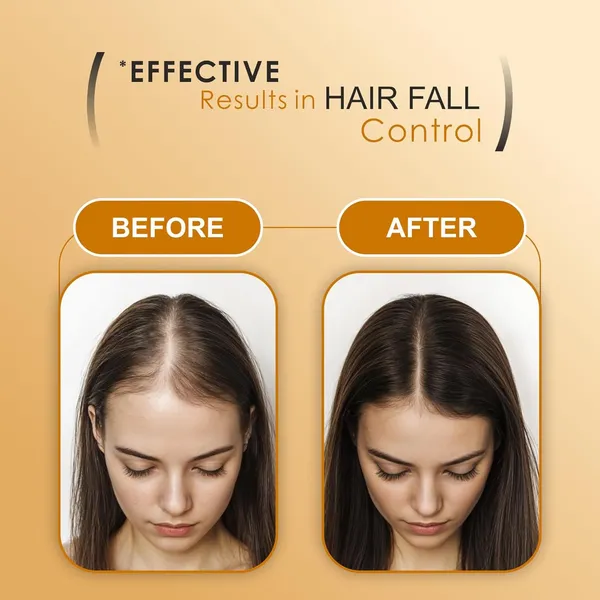 Anti_Hair_Fall_Shampoo_|_Helps_Reducing_Hair_Loss_&_Breakage_|_With_Biotin_|_Suitable_For_All_Hair_Types_|_For_Men_&_Women_-_300Ml