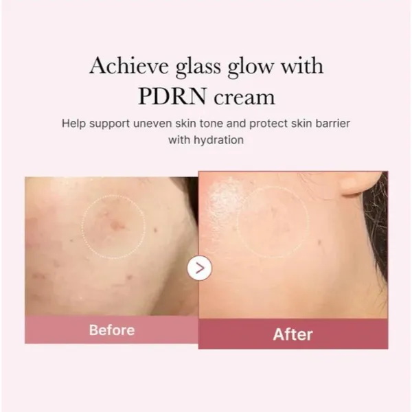 Medicube_PDRN_Pink_Hyaluronic_Moisturizing_Cream_-_50_ml