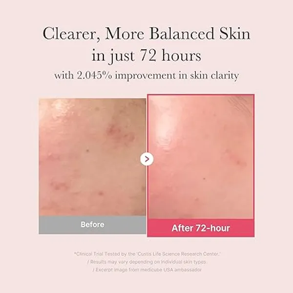 Medicube_TXA_+_Niacinamide_15%_Glow_Facial_Serum_-_30_ml
