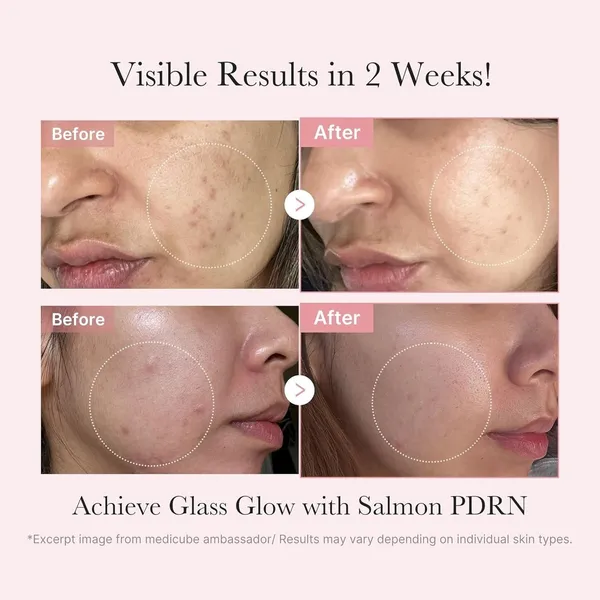 Medicube_PDRN_Collagen_Cruelty-Free_Glow_Kit