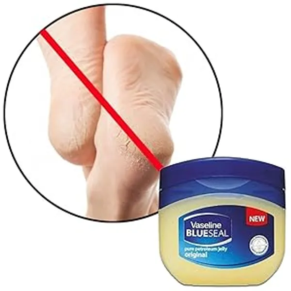 Vaseline_Blue_Pure_Petroleum_Jelly__(250ml)