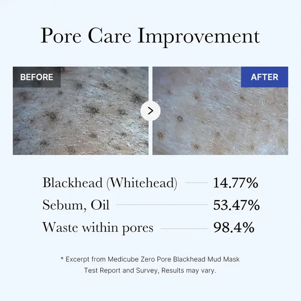 Medicube_Zero_Pore_Blackhead_Mud_Mask_-_100_g