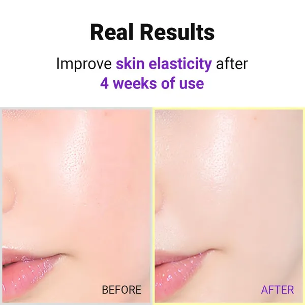 Isntree_White_Hyper_Retinol_Ex_1.0_Serum_20ml