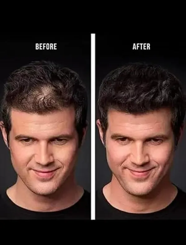 Toppik_Hair_Building_Fibers_Dark_Brown_27.5_g