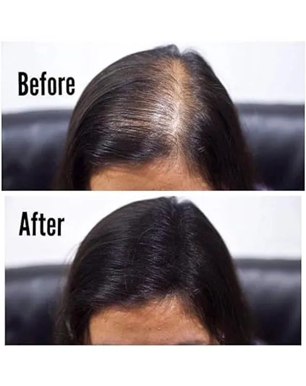 Toppik_Hair_Building_Fibers_Dark_Brown_27.5_g