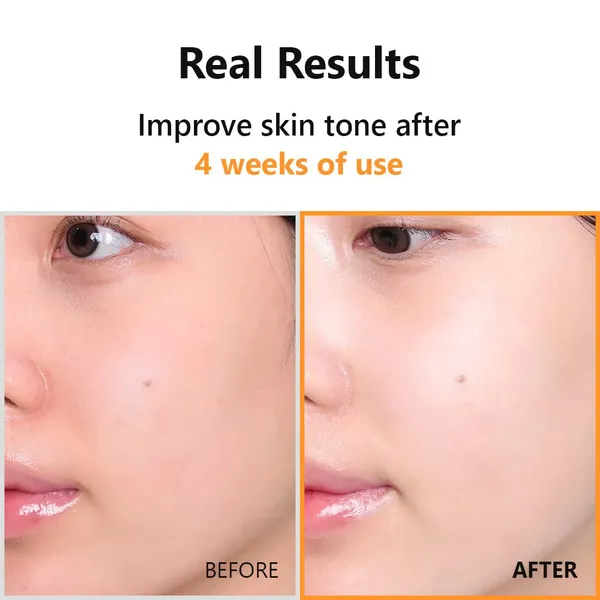 Isntree_White__Hyper_Vitamin_C_23_Serum_20ml
