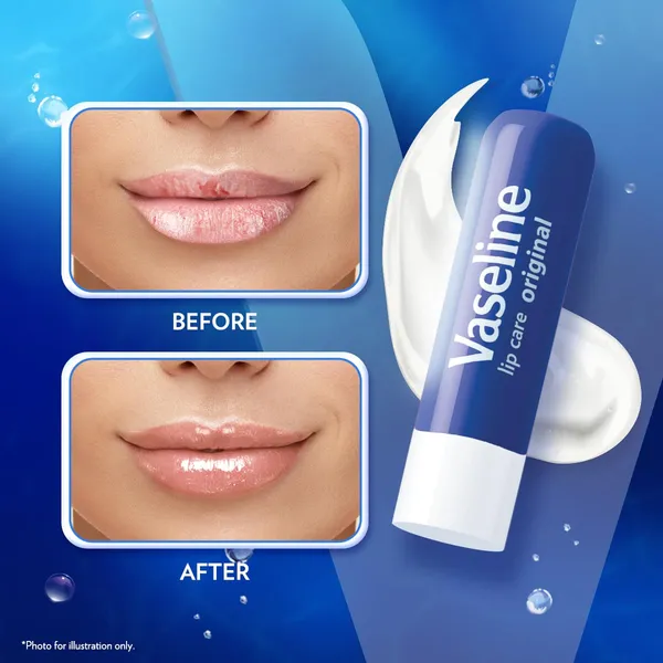 Vaseline_Lip_Therapy_Original_Stick,_4.8_g