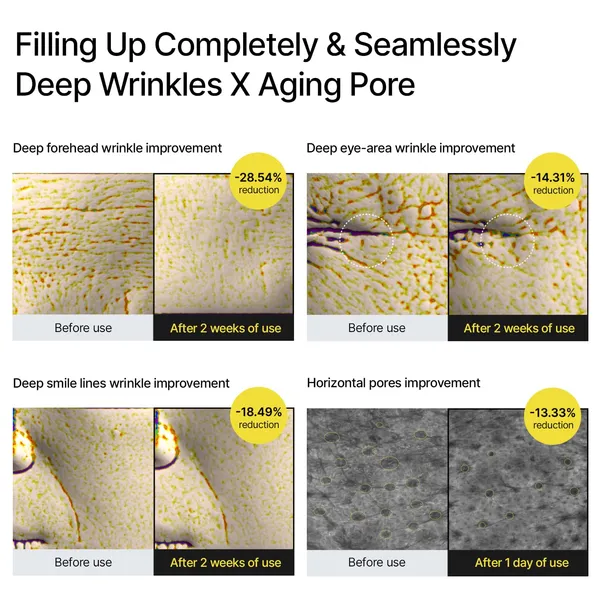 Celimax_Vita_A_Retinal_Shot_Tightening_Booster_With_0.1_Retinol_Matrixyl_Niacinamide_Pore_Minimizer_Wrinkles_Fine_Lines_Firmer_Skin_Korean_Face_Serum_15Ml_For_Women