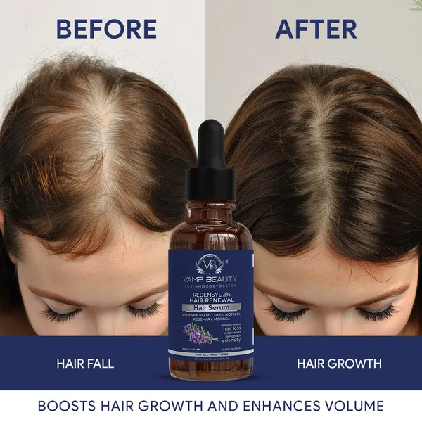 Redensyl_2%_Hair_Growth_Serum