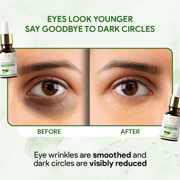 Yam_Root_&_Cucumber_Revitalizing_Elixir_Under_Eye_Serum_With_Goodness_Of_Caffiene,_Lactic_Acid,_Lemon