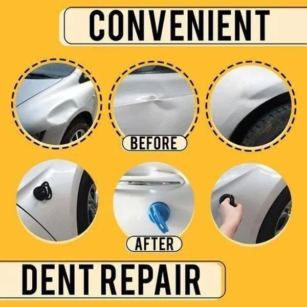 Dent_Puller-_Advance_Dent_Puller_(Assorted_Colour)