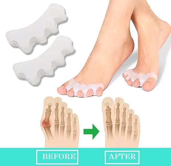 White_Toe_Separator_For_Feet_Toe_Spacers_Correct_Toes_Yoga_Silicone_Hammer_Toe_Corrector_For_Women_&_Men_Correct_Toe_Straighteners_For_Overlapping_Toes