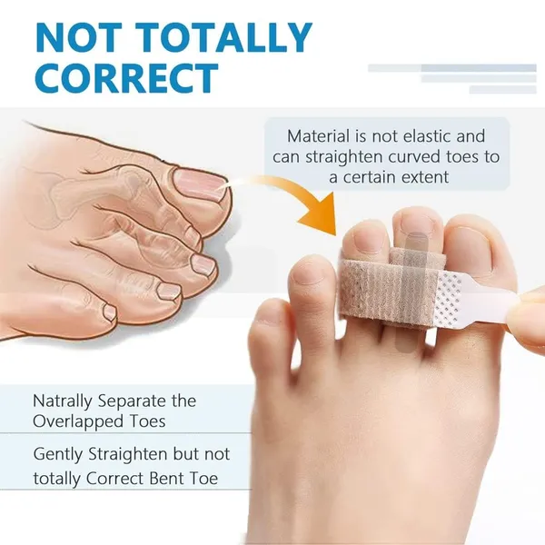 Gray_Toe_Separator_For_Feet_Toe_Spacers_Correct_Toes_Yoga_Silicone_Hammer_Toe_Corrector_For_Women_&_Men_Correct_Toe_Straighteners_For_Overlapping_Toes