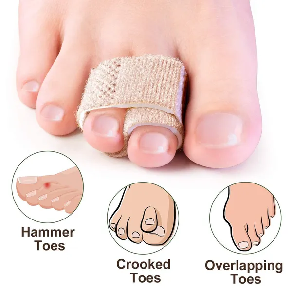 Gray_Toe_Separator_For_Feet_Toe_Spacers_Correct_Toes_Yoga_Silicone_Hammer_Toe_Corrector_For_Women_&_Men_Correct_Toe_Straighteners_For_Overlapping_Toes