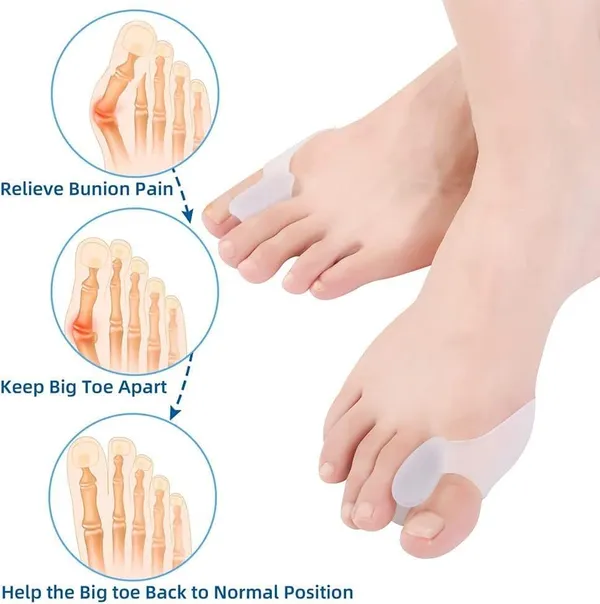 White_Bunion_Corrector_Silicone_Toe_Separators_For_Fast_Pain_Relief_Orthopedic_Bunion_Spacers_Spreader
