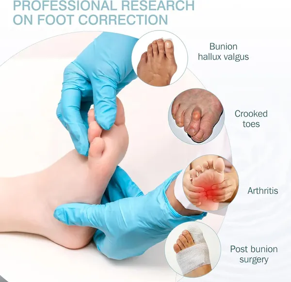 Blue_Bunion_Corrector_Silicone_Toe_Separators_For_Fast_Pain_Relief_Orthopedic_Bunion_Spacers_Spreader