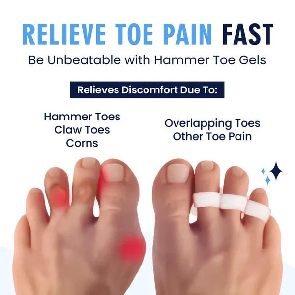 White_Bunion_Corrector_Silicone_Toe_Separators_For_Fast_Pain_Relief_Orthopedic_Bunion_Spacers_Spreader_Combo_of_6
