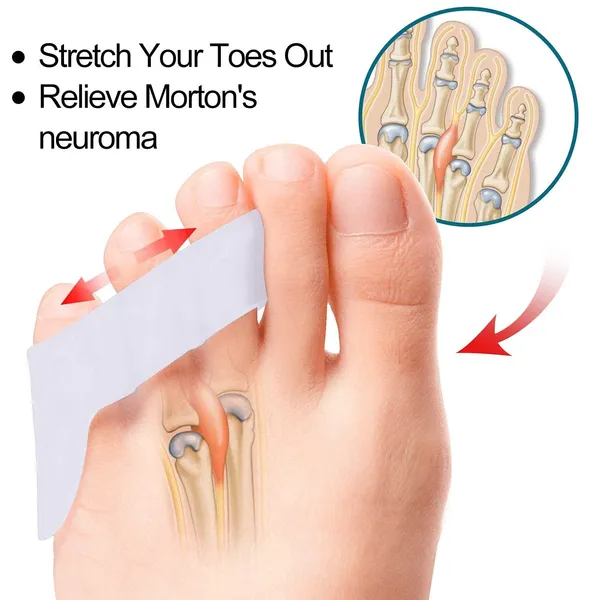 White_Bunion_Corrector_Silicone_Toe_Separators_For_Fast_Pain_Relief_Orthopedic_Bunion_Spacers_Spreader