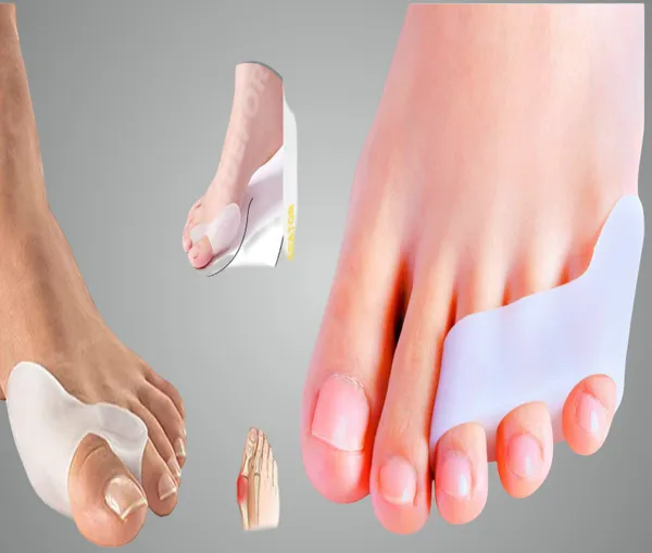 White_Bunion_Corrector_Silicone_Toe_Separators_For_Fast_Pain_Relief_Orthopedic_Bunion_Spacers_Spreader_Combo_of_4