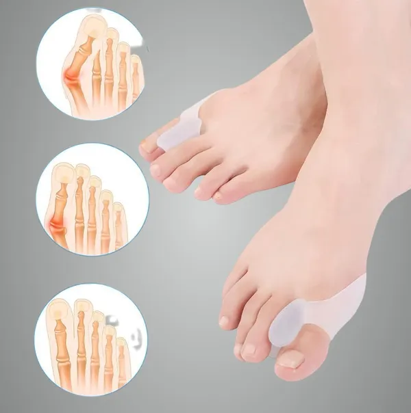 White_Bunion_Corrector_Silicone_Toe_Separators_For_Fast_Pain_Relief_Orthopedic_Bunion_Spacers_Spreader
