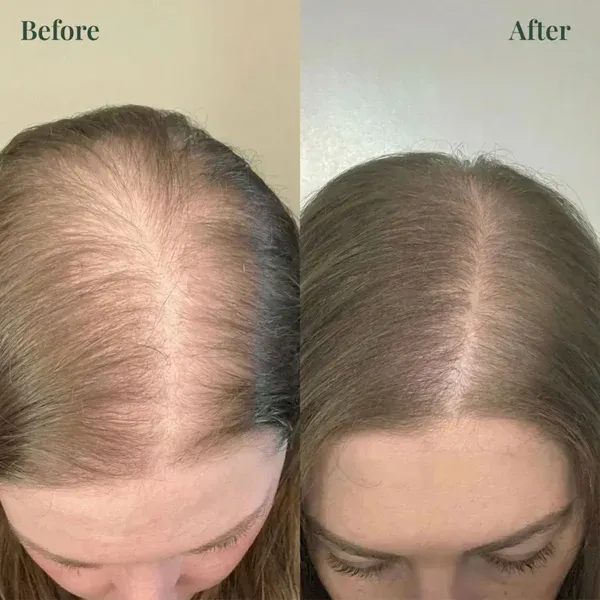 Kerarose_Rosemary_Hair_Growth_Shampoo_(Buy_1_get_1_one_free)