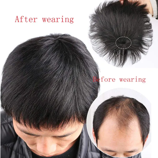 Black_Feel_Real_Human_Hair_Topper_For_Covered_Baldness_Top_Area_With_Clip_On_Hairpiece_For_Daily/Party_Use_(5X5_U_Shape)_For_Women