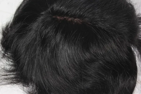 Men's_Human_Hair_Replacement_System