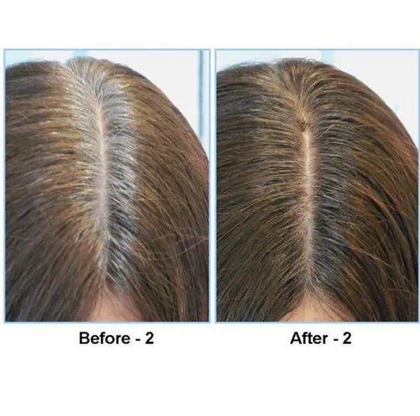 Hair_Shadow_Powder_Concealer