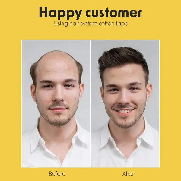 Hair_Patch_Double_Sided_Tape