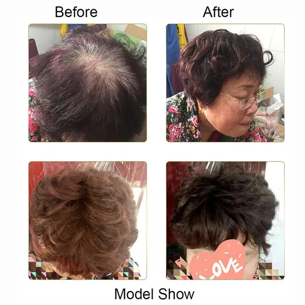 Human_Hair_Topper_for_Thinning_Hair