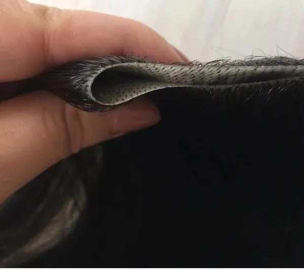 Men's_Frontal_Hair_Replacement_System