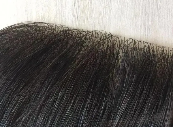 Men's_Frontal_Hair_Replacement_System