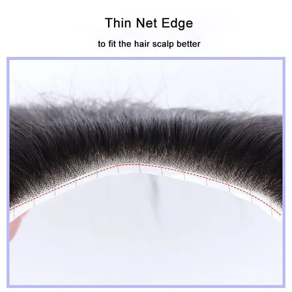 Men's_Frontal_Hair_Replacement_System