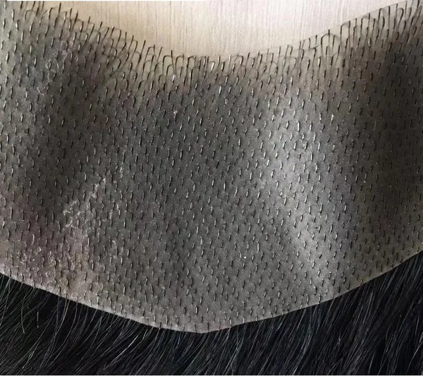 Men's_Frontal_Hair_Replacement_System
