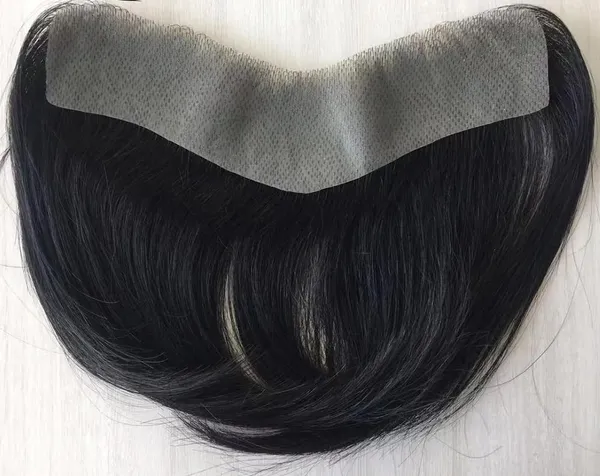 Men's_Frontal_Hair_Replacement_System