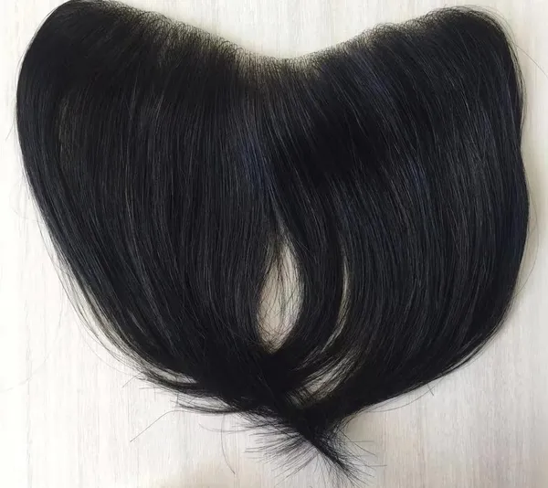 Men's_Frontal_Hair_Replacement_System