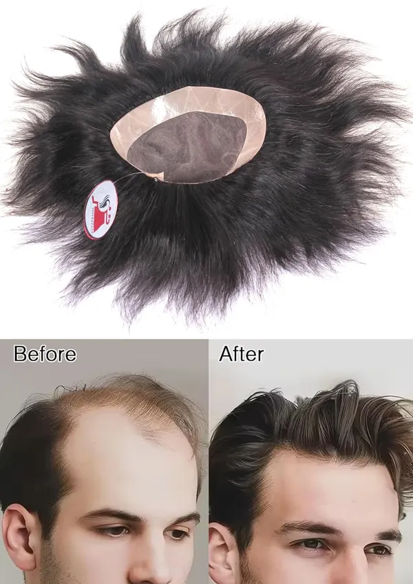 Men's_Mono_Base_Human_Hair_Patch
