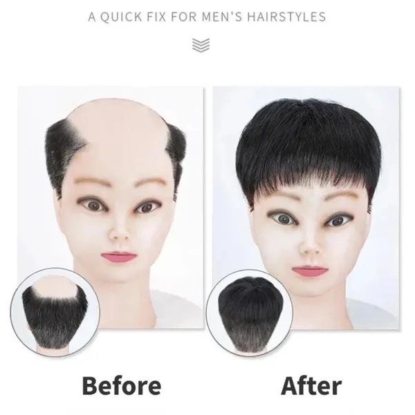Black_Pre-Cut_Hair_Topper_Clip-On_Patch:_Freestyle_No_Glue/Tape_Needed_Easy_To_Remove_&_Fit_No_Salon_Maintenance_Invisible_Hairline_Double_Layer_Natural_Human_Hair._By_(18_X_20_Cm)_For_Women