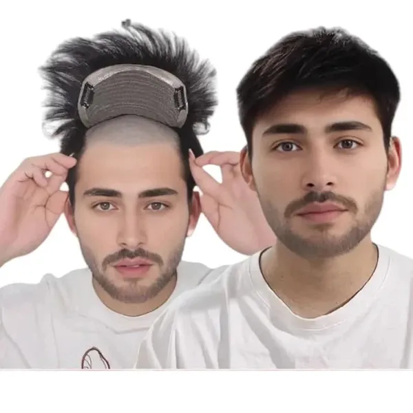 Black_Hair_Topper_With_Perm_Cut_Style_Natural_Clip-On_Bald_Spot_Coverage_Patch_Lightweight_&_Comfortable_Easy_To_Attach_&_Remove_Natural-Looking_Premium_Human_Hair_Wig_For_Thinning_Hair_Solution_(18_X_20_Cm)_For_Women