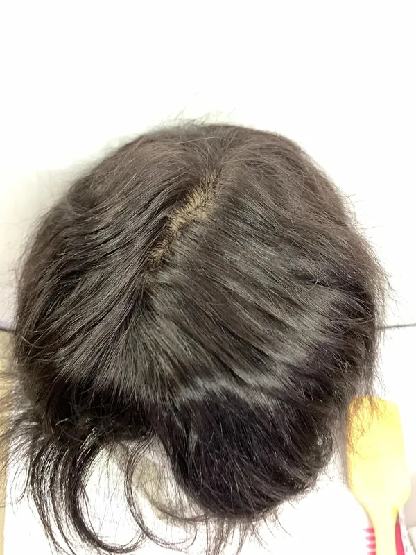 Black_Hair_Patch_Double_Layer_Mirage_100%_Remy_Human_Hair_Toupee_Natural_Match_Ready-To-Wear_(Old_Stock_Clearance_Same_Product_Guaranteed)_(Mirage9X6)_For_Women