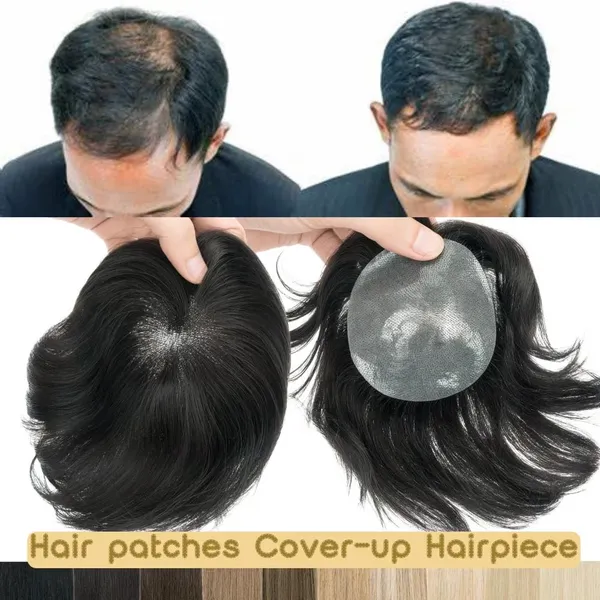 Black_Pu_Skin_Bald_Spot_Hair_Patch_3.2_Inch_(8_Cm)_Base_With_6_Inch_Natural_Straight_Hair_Remy_Human_Hair_Frontal_Topper_&_Cover-Up_Hairpiece_For_Women
