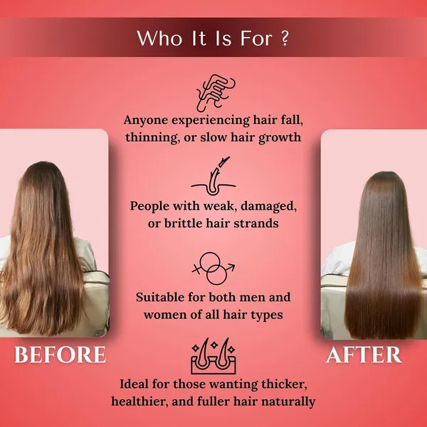Hair_Growth_Serum_With_Redensyl_&_Rosemary_For_All_Hair_Types_(30_Ml)