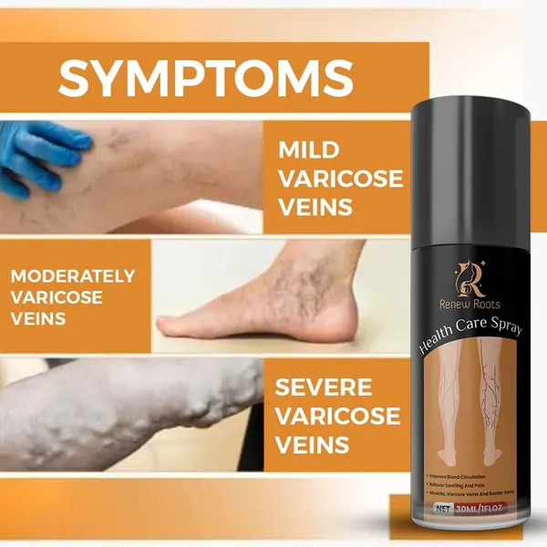 Natural_Herbal_Varicose_Pain_Relief_Oil|_Fast_Action_Formula_For_Leg,_Nerve_&_Vein_Pain_(30_Ml)